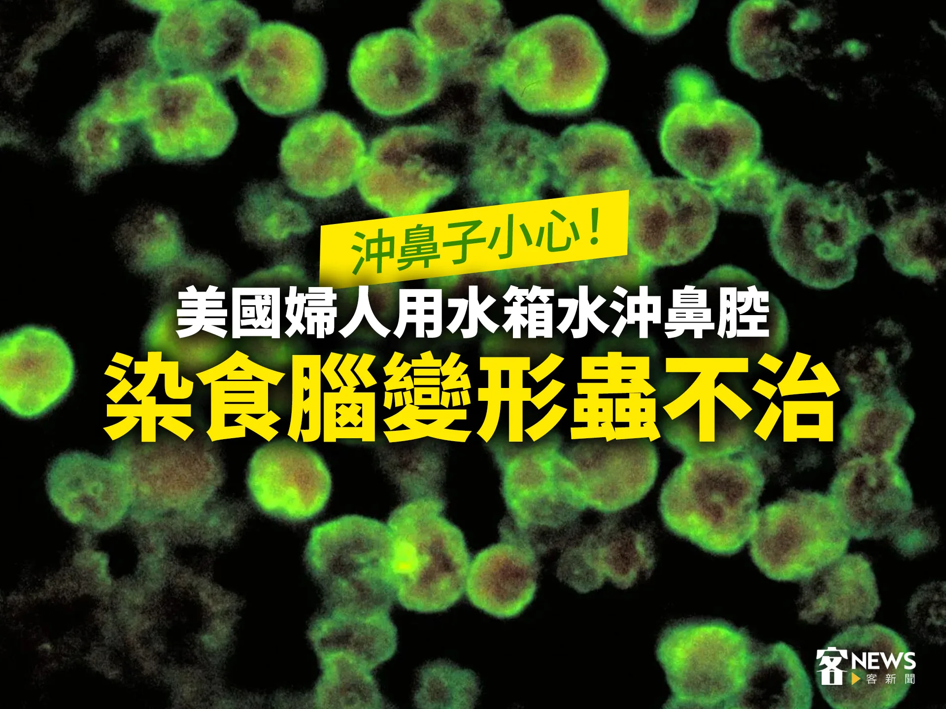 沖鼻子小心！美國婦人用水箱水沖鼻腔　染食腦變形蟲不治's story cover image