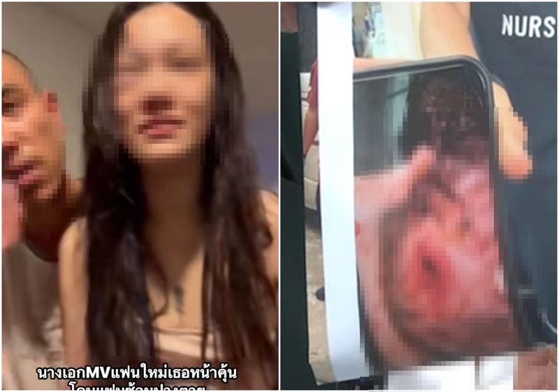 有片／女星遭警二代前男友家暴！腫成豬頭還噴血　恐怖囚禁畫面曝光's story cover image
